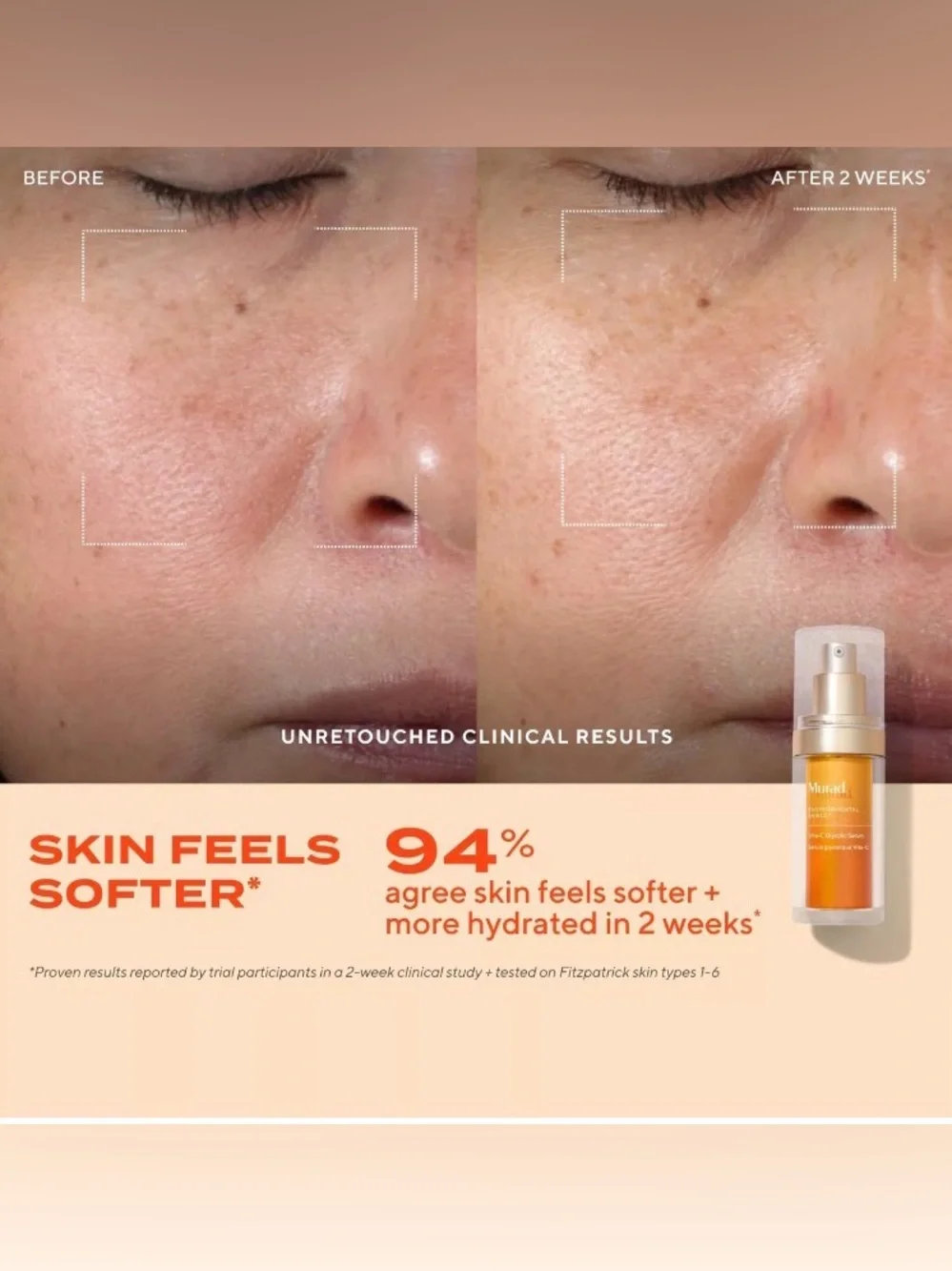 Murad dramatically brightens